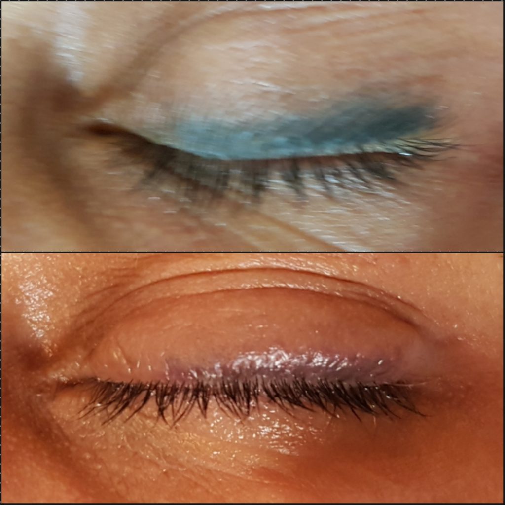 microblading eyeliner removal.  Does permanent makeup fade completely