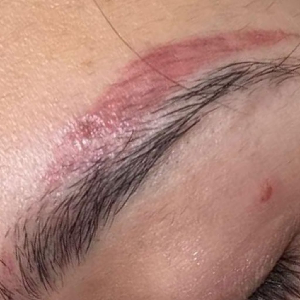 When brows go red after the first laser session